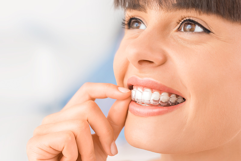 Invisalign in Spokane