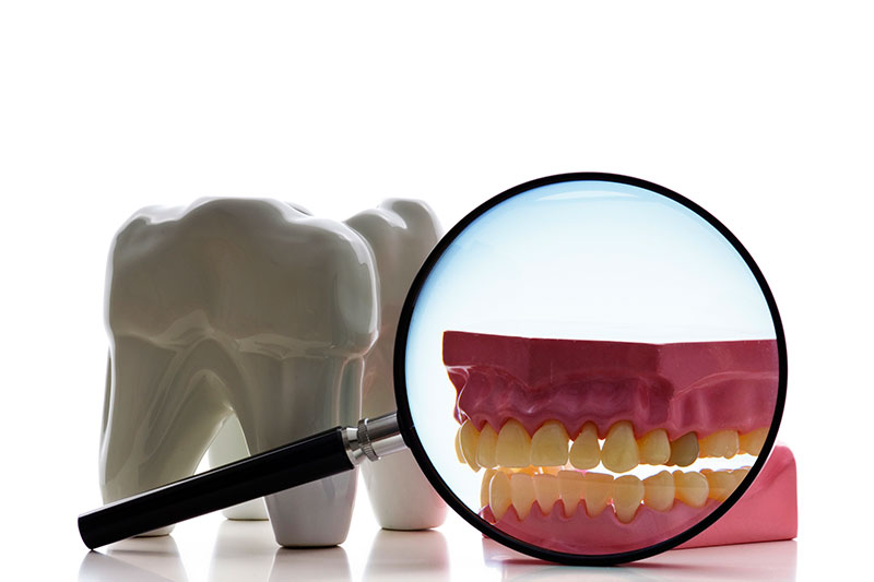 Root Canal Treatment in Spokane