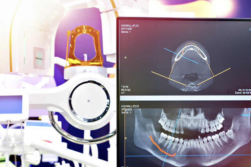 Digital X-Rays in Spokane