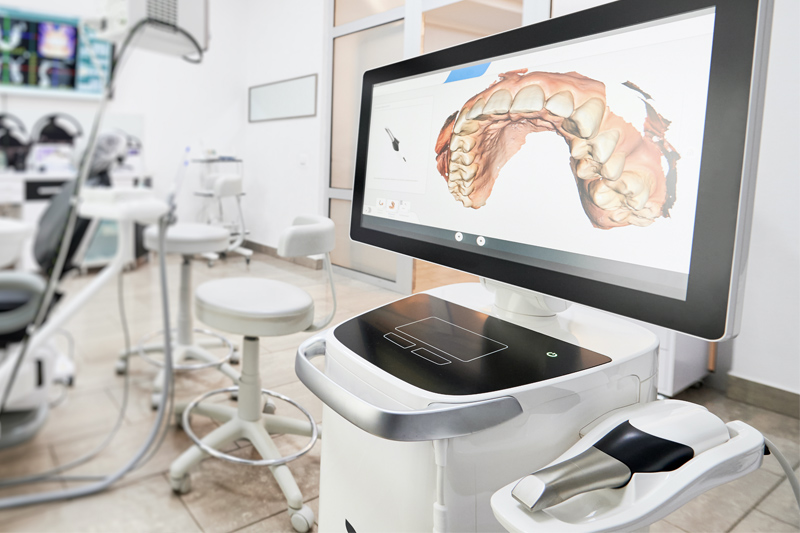 iTero Intra-Oral Scanner in Spokane